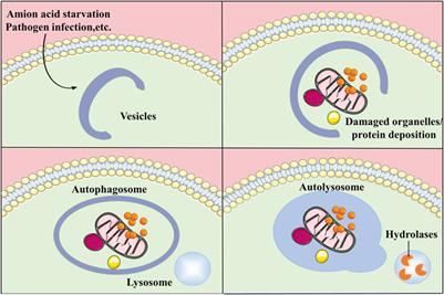 Research progress on the relationship between autophagy and chronic complications of diabetes